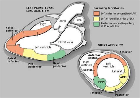 mild basal inferior wall hypokinesis.